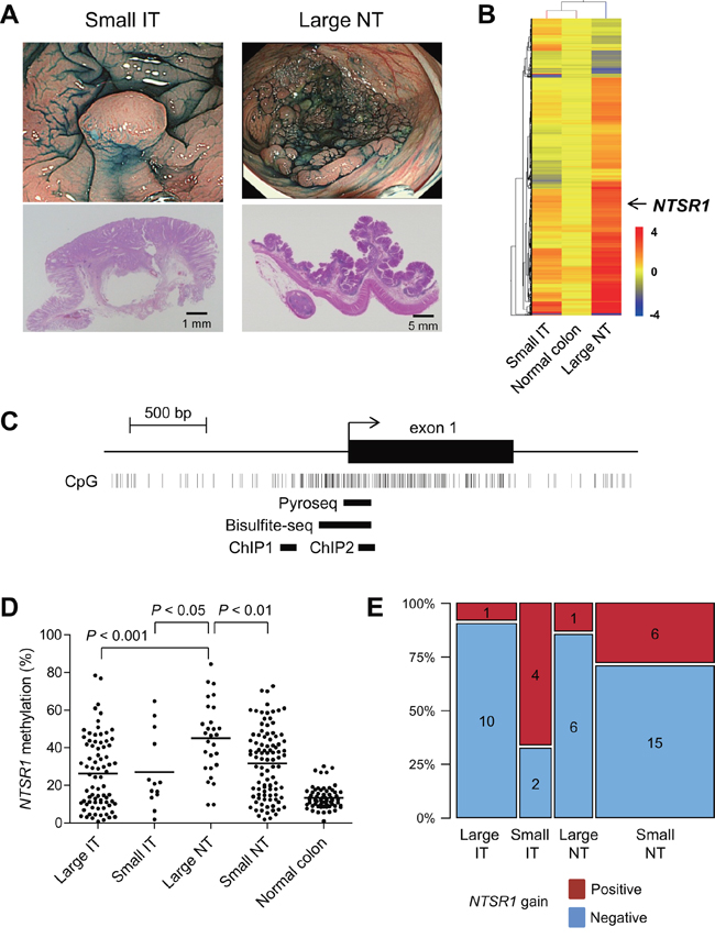 Identification of NTSR1 methylation in large noninvasive tumors.