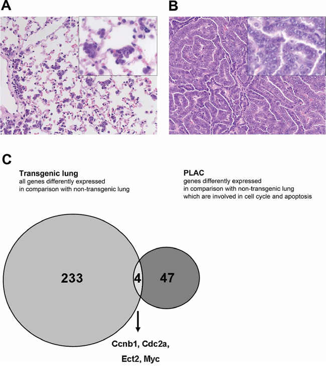 Differentially expressed genes in c-Myc transgenic lung and lung tumors.