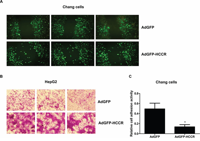 HCCR affects the migration, invasion and adhesion of hepatocytes.