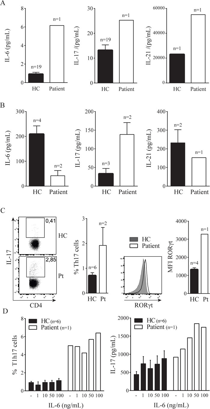 STAT3 Pro471Arg mutation causes hyperactive Th17 pathway and aberrant B cell phenotype.