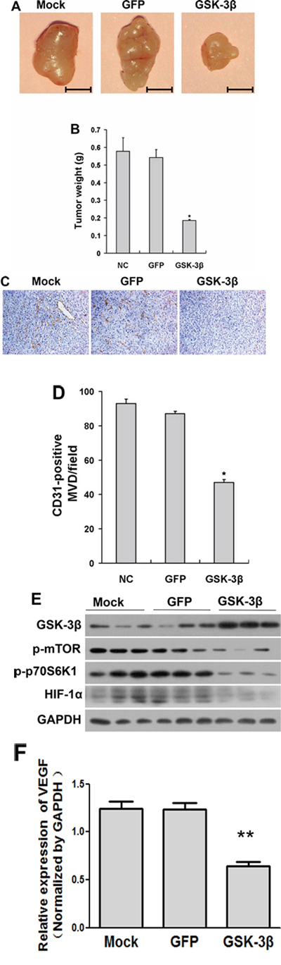 Overexpression of GSK-3&#x03B2; decreased tumor growth in vivo.