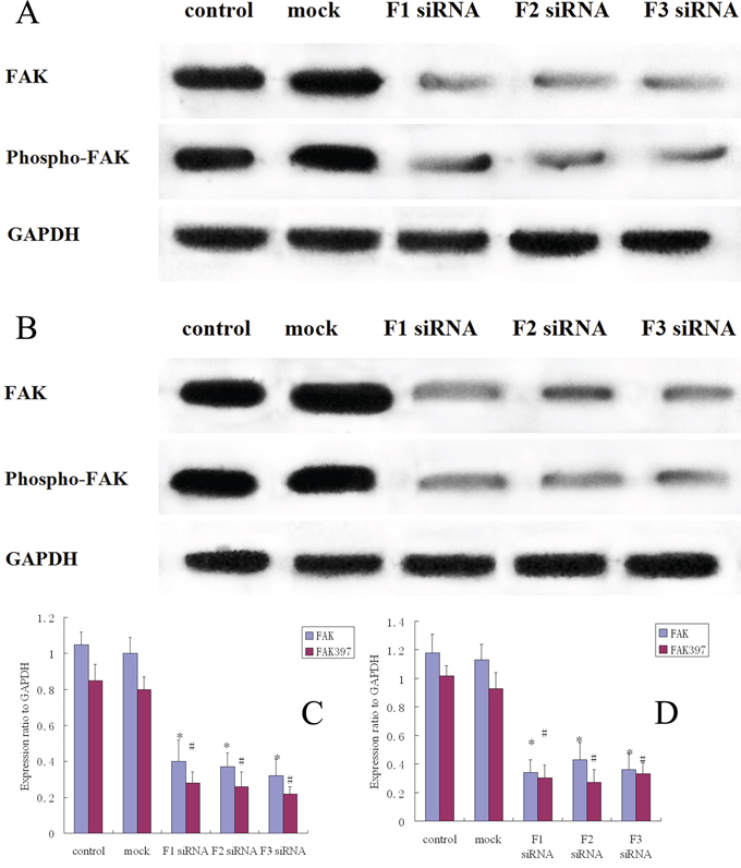 FAK protein expression and FAK phosphorylation in siRNA treated osteosarcoma, control and mock group cells.