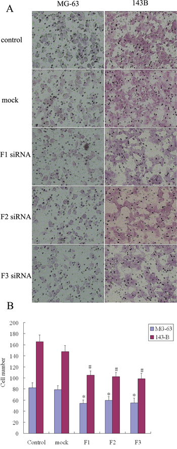 The effect of FAK expression inhibition on osteosarcoma cell migration.