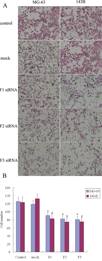 The effect of FAK expression inhibition on osteosarcoma cell invasion.