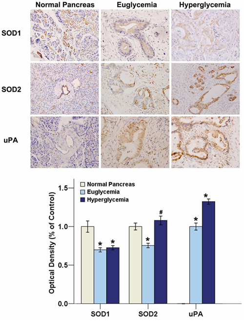 Hyperglycemia promotes SOD2 and uPA expressions in human PC tissues.