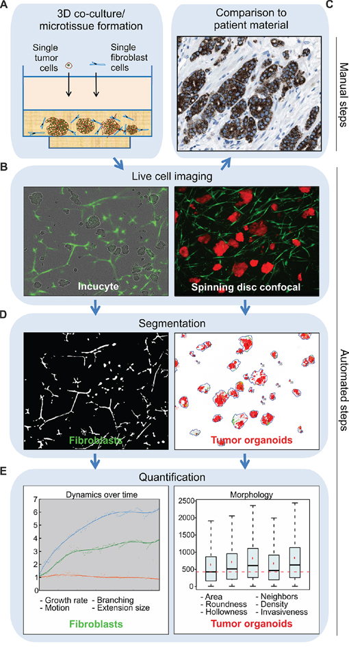 Tracking of tumor-stroma morphology and dynamics in microtissues by automated image analysis.