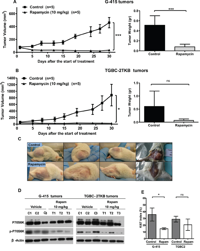 In vivo efficacy of rapamycin on human gallbladder cancer xenografts.