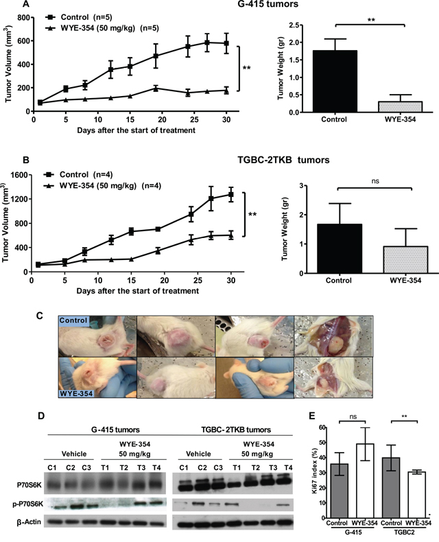 In vivo efficacy of WYE-354 on human gallbladder cancer xenografts.