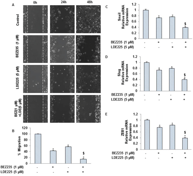 NVP-LDE-225, NVP-BEZ-235 and their combination regulate the pancreatic CSC motility and migration, and the expression of EMT-related genes.