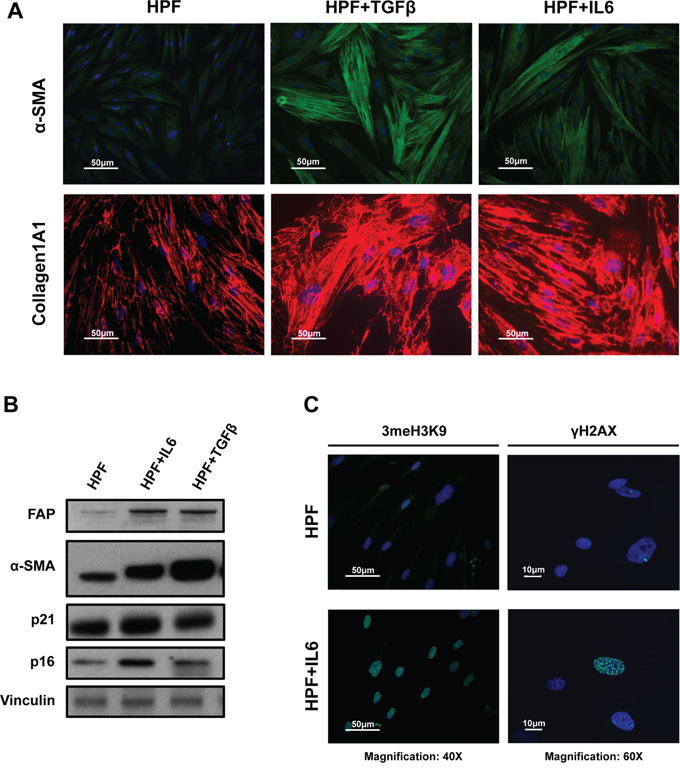 IL6-induced phenoconversion of normal prostate fibroblasts into activated fibroblasts.