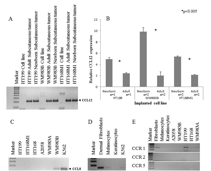 Qualitative and quantitative expression of CCL12 and CCL8.