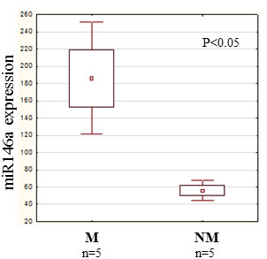 miR146a expression in human primary melanoma.