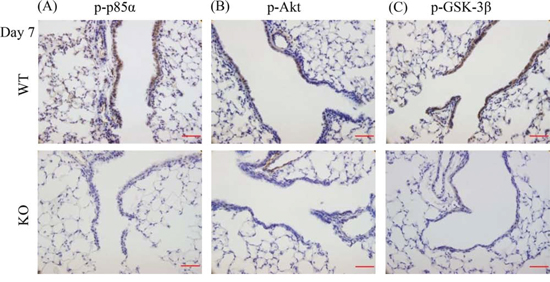XB130 deficiency reduced phosphorylation of molecules on PI3K/Akt cascade during small airway epithelial repair.