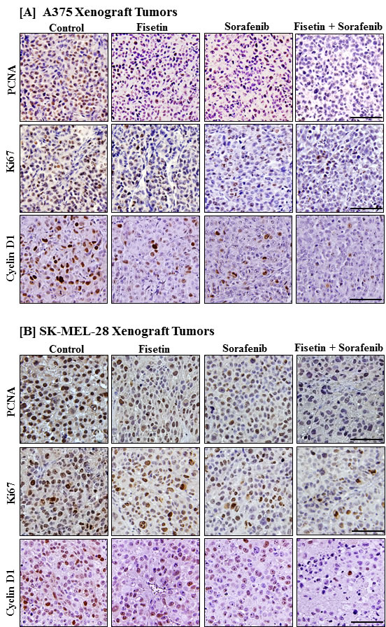 Effects of fisetin, sorafenib and their combination on markers of proliferation in tumor sections of athymic nude mice implanted with BRAF-mutated melanoma cells.