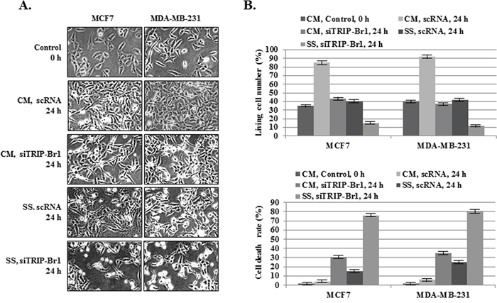 Inhibitory role of TRIP-Br1 in serum starvation-induced cell death.