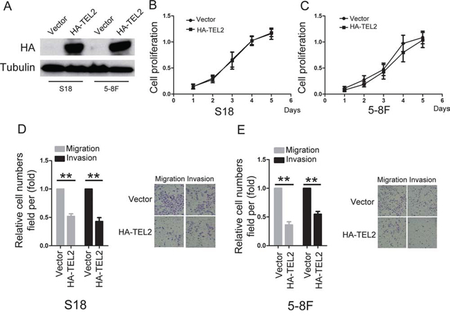 Overexpression of TEL2 suppresses migration and invasion of NPC cells.
