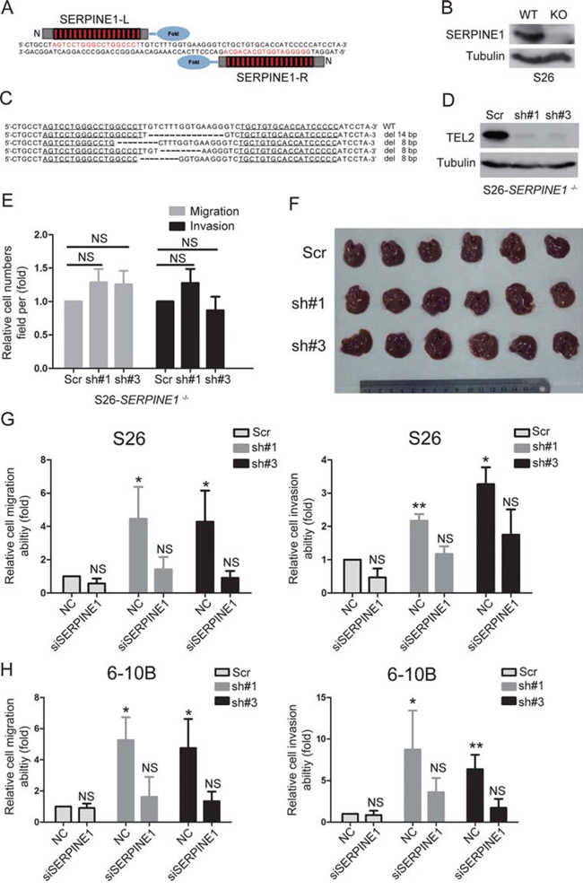 The promotion of NPC metastasis induced by down-regulating TEL2 depends on the up-regulation of SERPINE1.