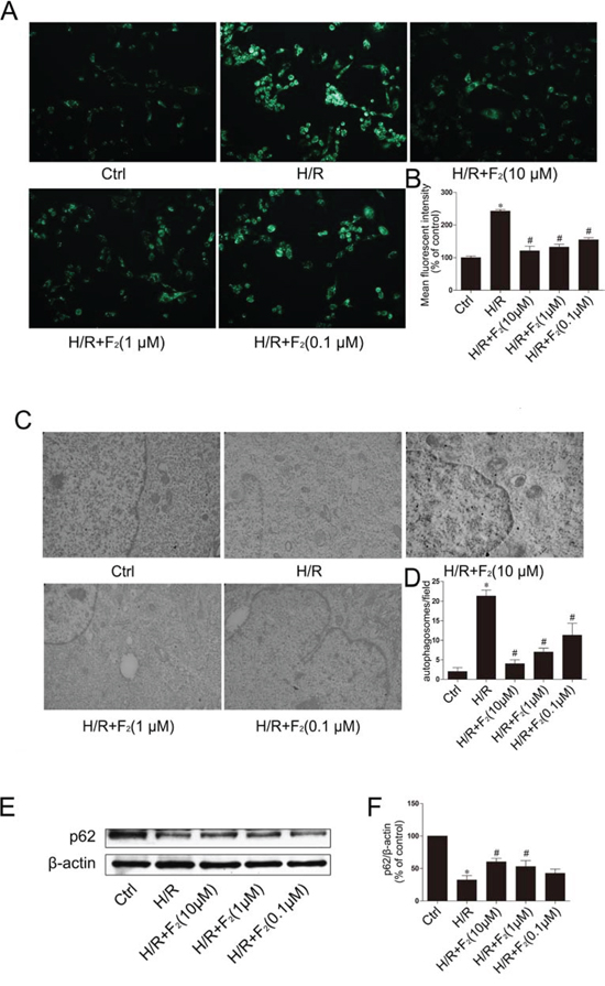 Effect of F2 on H/R-induced autophagy in H9c2 cells.