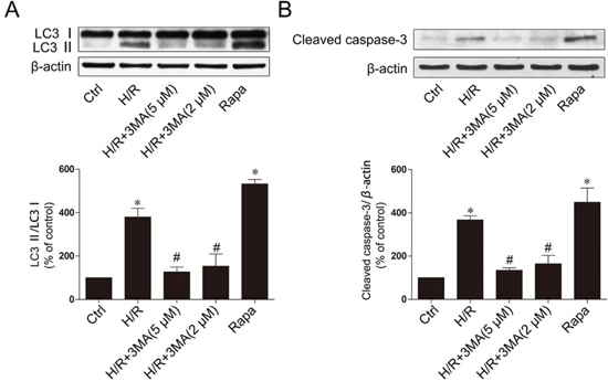 Inhibition of autophagy decrease apoptotic cell death.