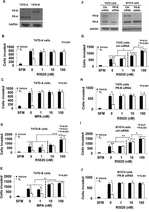 PR-A vs. PR-B mediated effects of progestins on invasiveness of breast cancer cells.