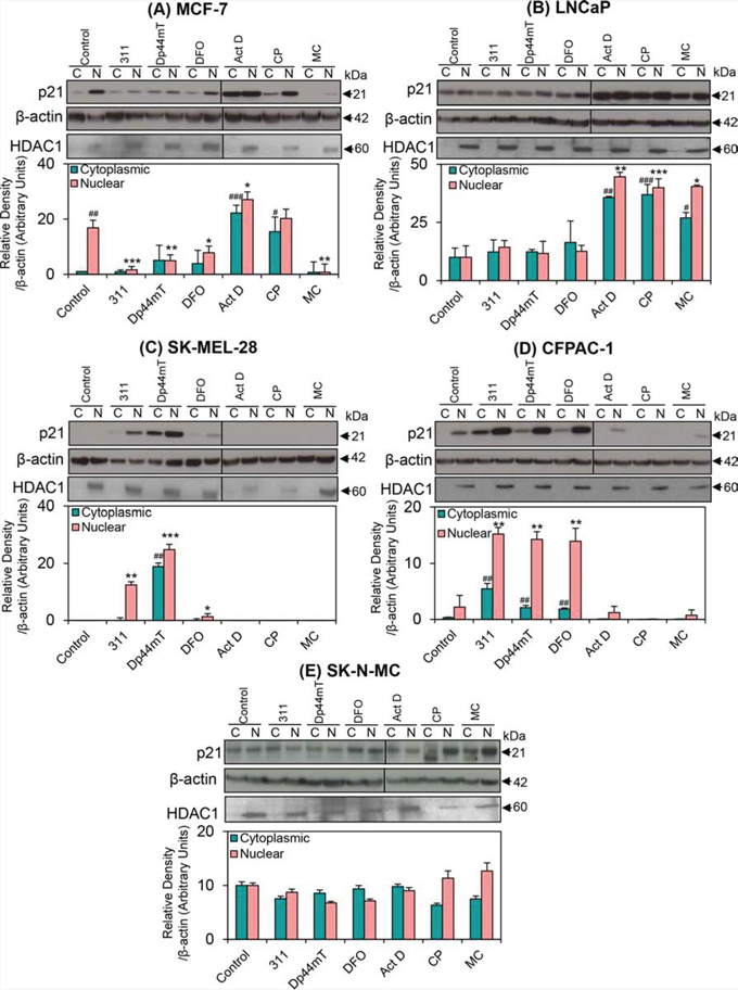 The effect of the chelators 311, Dp44mT, or DFO, and the DNA-damaging agents, Act D, CP or MC on the cytoplasmic and nuclear expression of p21 in five different tumor cell lines.