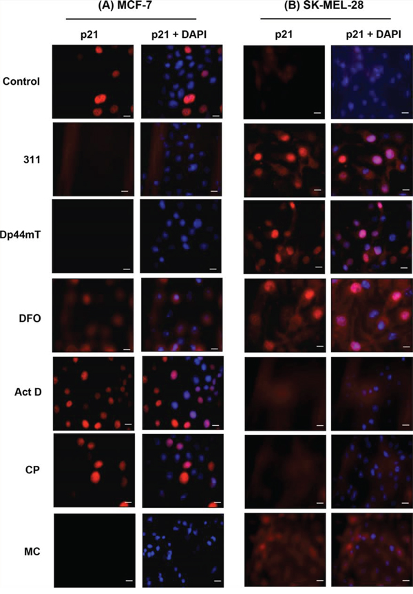 Immunofluorescence studies examining the cellular distribution of p21 observed in: A. MCF-7 cells, or B. SK-MEL-28 cells, in response to chelators or DNA-damaging agents.