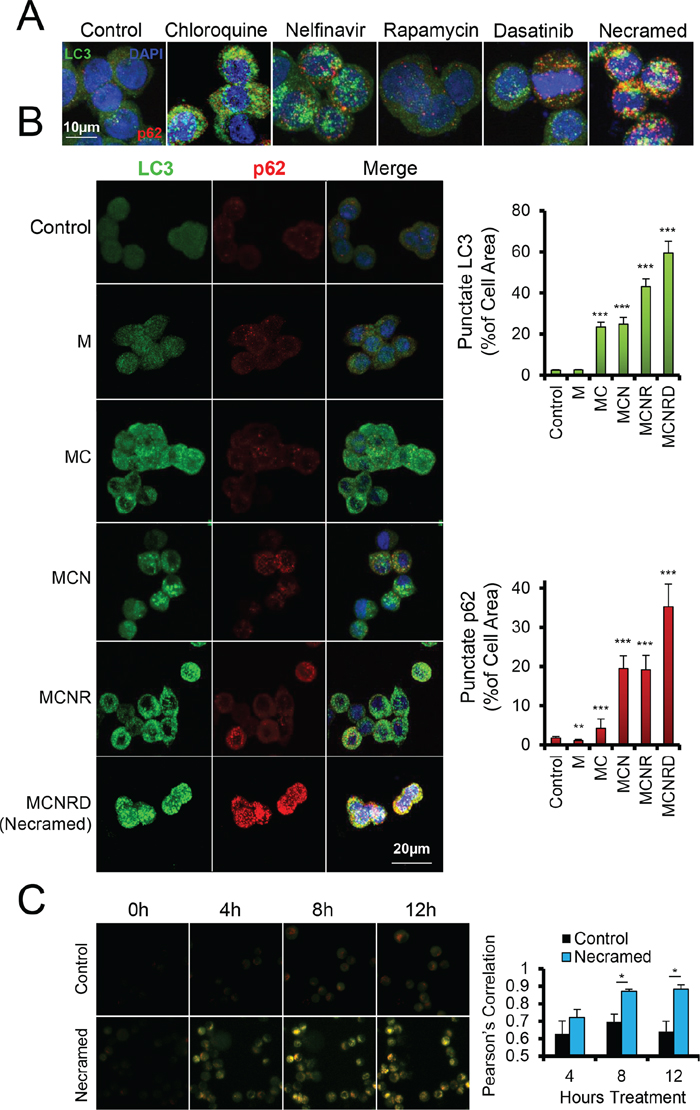 Measurement of dysregulated autophagy by fluorescent microscopy.