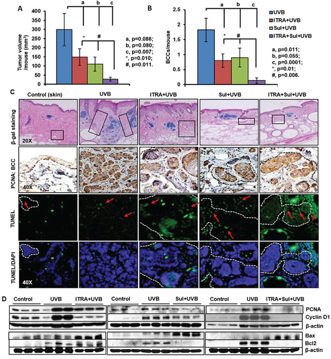 The NSAID Sulindac (Sul) potentiates SMO inhibitor, itraconazole (ITRA)-mediated inhibition of UVB-induced growth of BCCs in Ptch1+/&minus;/SKH-1 mice.