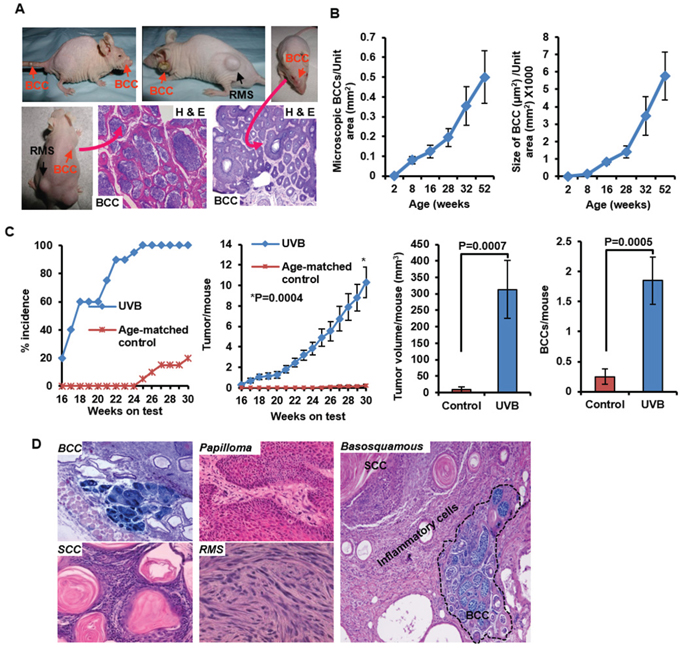 Development of spontaneous and UVB-induced BCCs in Ptch1+/&minus;/SKH-1 hairless mice.