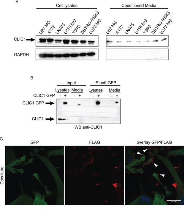 CLIC1 protein is secreted by glioblastoma cells.