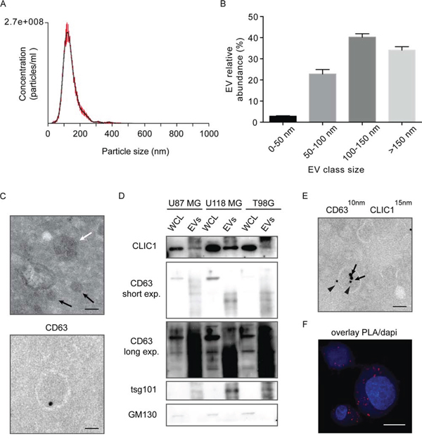 CLIC1 protein is secreted by GBM cells via Evs.