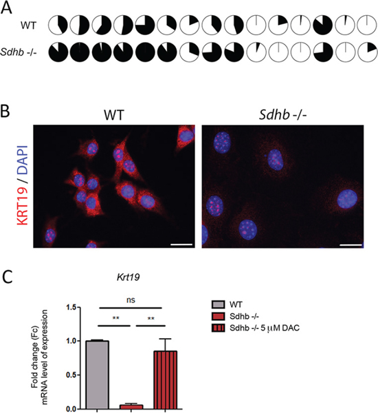 KRT19 loss of expression is driven by hypermethylation.