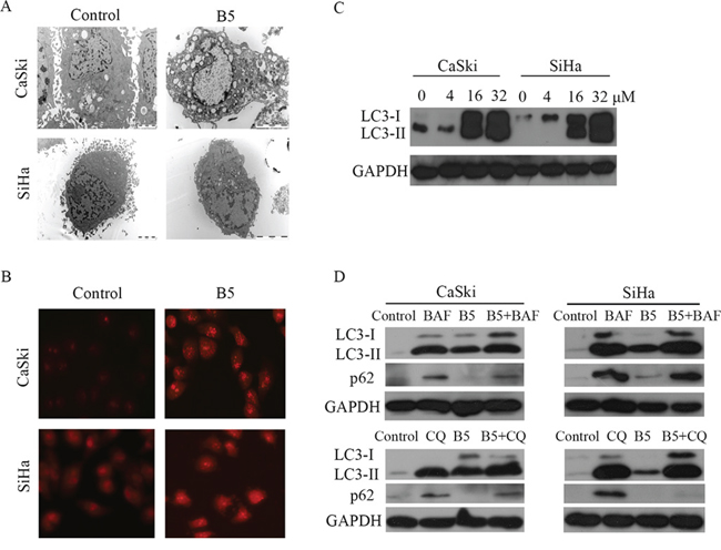 B5-induced autophagy in CaSki and SiHa cells.
