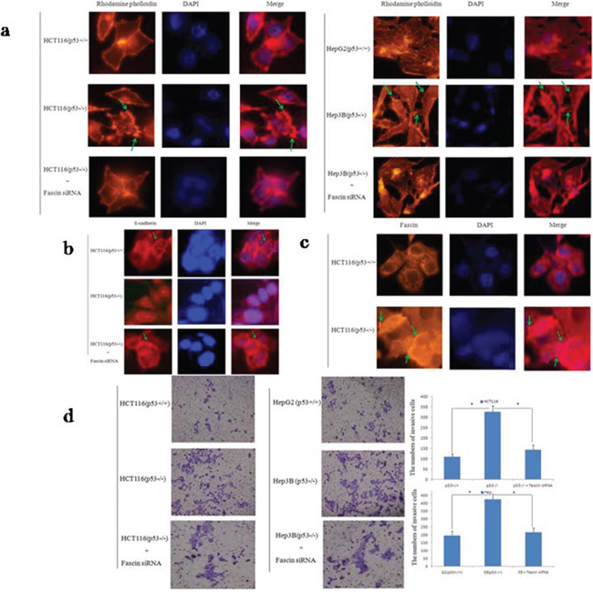 p53 and Fascin correlate with colorectal cancer cell migration in vitro.