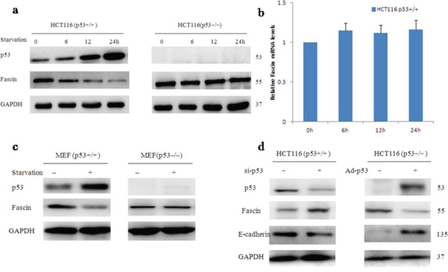 Wild-type p53 inhibits Fascin protein expression.