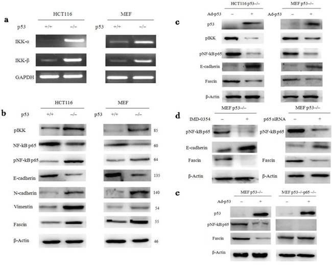 NF-&#x03BA;B is a key determinant for p53 deletion-mediated the up-regulation of Fascin.