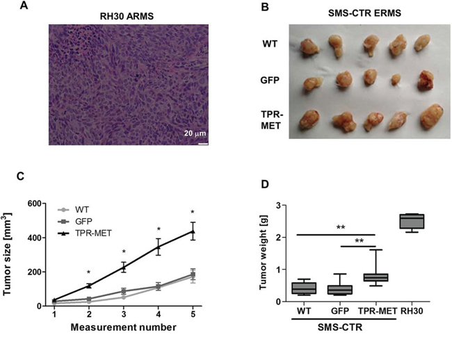 Activation of MET signaling in SMS-CTR ERMS cells enhances tumor growth in vivo.