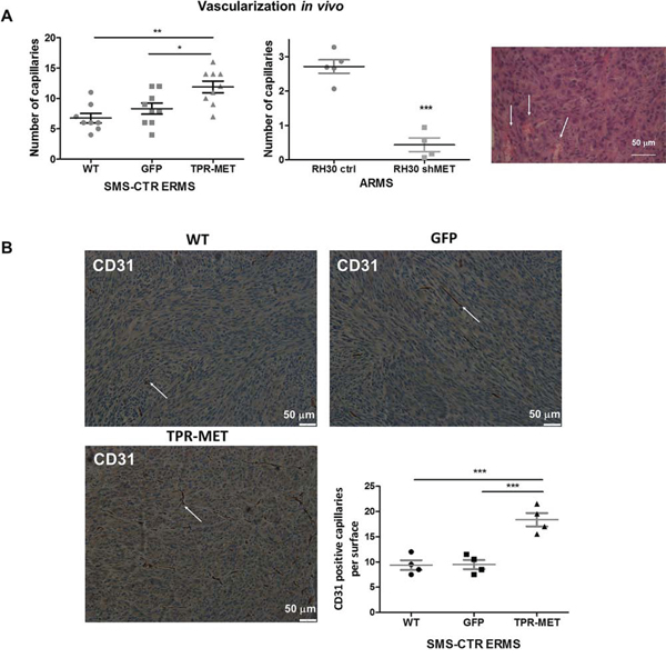 Activation of MET signaling in SMS-CTR ERMS enhances tumor vascularization in vivo, whereas MET silencing in RH30 ARMS exerts the opposite effects.