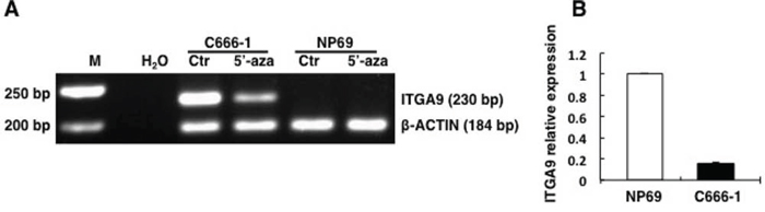 ITGA9 promoter is demethylated by demethylation reagent 5&#x2032;-aza-C in NPC C666&#x2013;1 cell line where its expression is also downregulated.