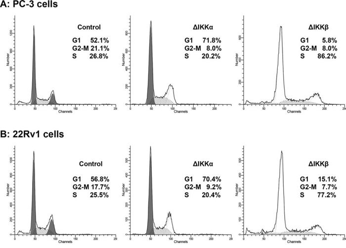 Silencing effect of IKK&#x03B1; and IKK&#x03B2; on cell cycle in human prostate cancer cells.