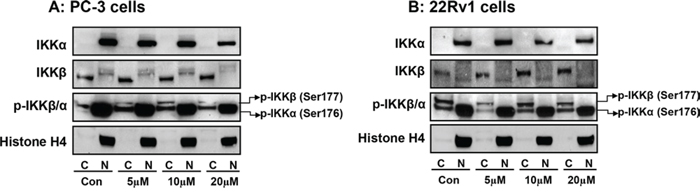 Effect of apigenin on sub-cellular distribution of IKK&#x03B1;, IKK&#x03B2; and its phosphorylated forms in human prostate cancer cells.