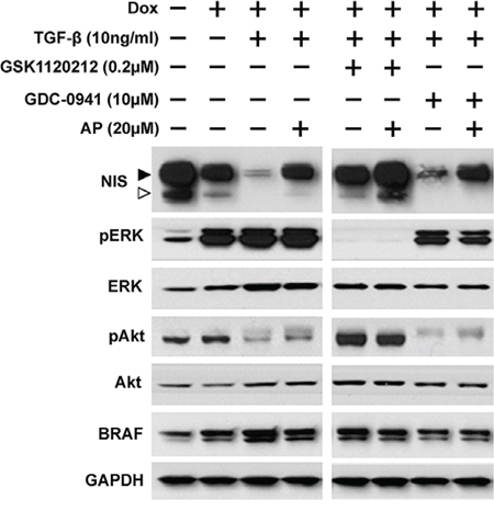 Apigenin counteracts TGF-&beta;'s effect on NIS reduction.