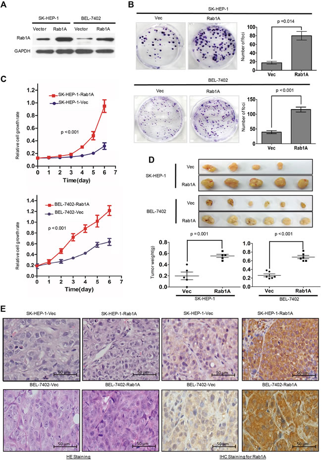 Rab1A overexpression promotes oncogenic growth of HCC