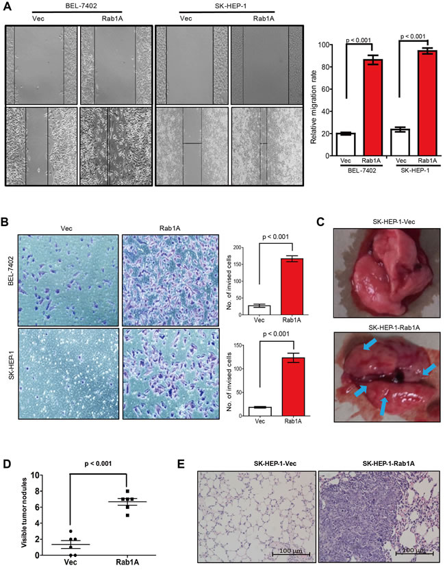 Rab1A overexpression promotes HCC cell migration, invasiveness and metastasis.