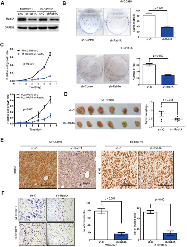 Rab1A knockdown inhibits oncogenic growth and migration of HCC cells.