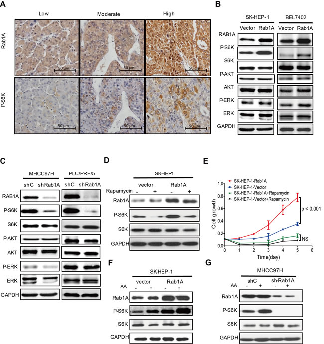 Rab1A overexpression potentiates AA-mTORC1 signaling and mTORC1-dependent oncogenic growth of HCC cells.