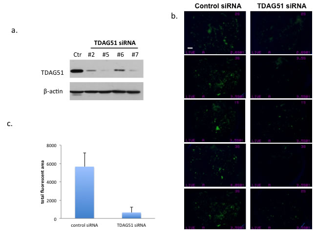 Suppression of TDAG51 expression reduced pulmonary metastasis of OS cells.