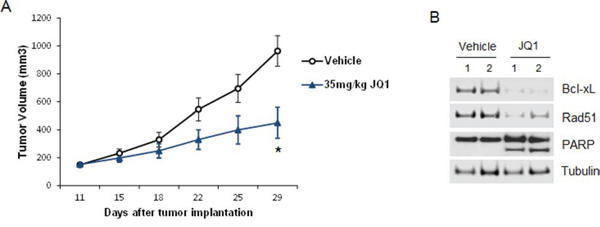 JQ1 inhibits UM tumor growth in vivo.