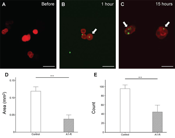 In vitro efficacy of S. typhimurium A1-R-GFP on HT-29-RFP colon cancer cells.
