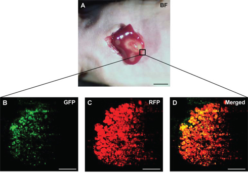 Intravital imaging of tumor-targeting S. typhimurium A1-R in HT-29 liver metastasis.